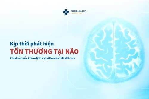 Kịp thời phát hiện tổn thương tại não khi khám sức khỏe định kỳ tại Bernard Healthcare